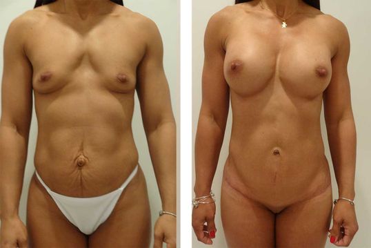 39 Year Old Mother - TABA - bodybyZ